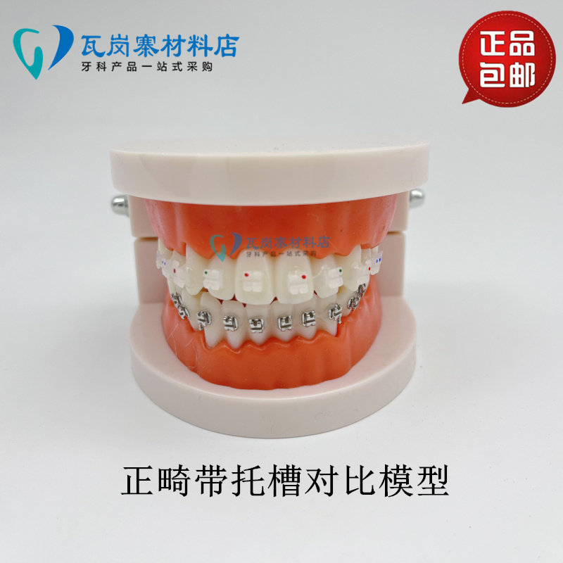 牙科正畸带托槽假牙模型 医患沟通教学模型 半金属半陶瓷托槽模型