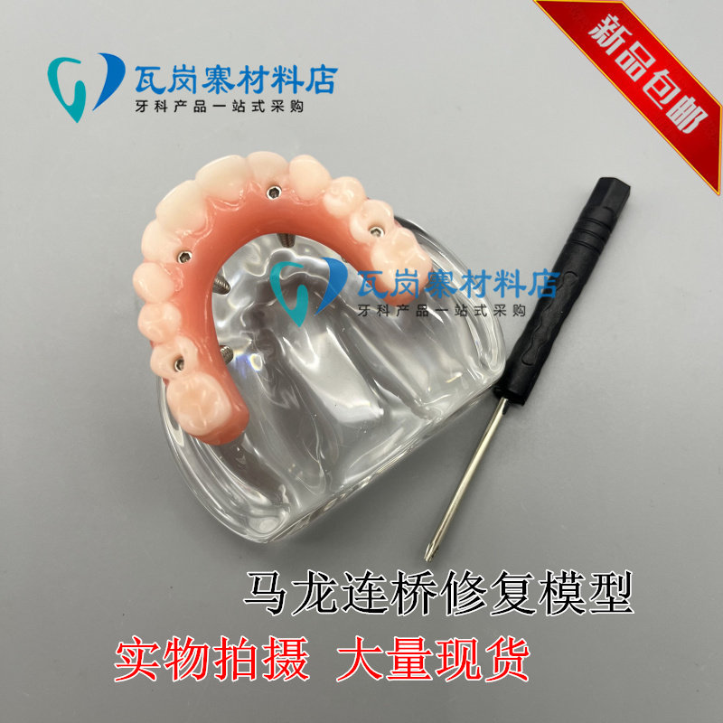 牙科口腔模型马龙连桥义齿修复种植牙齿仿真演示模拟教学医患交流