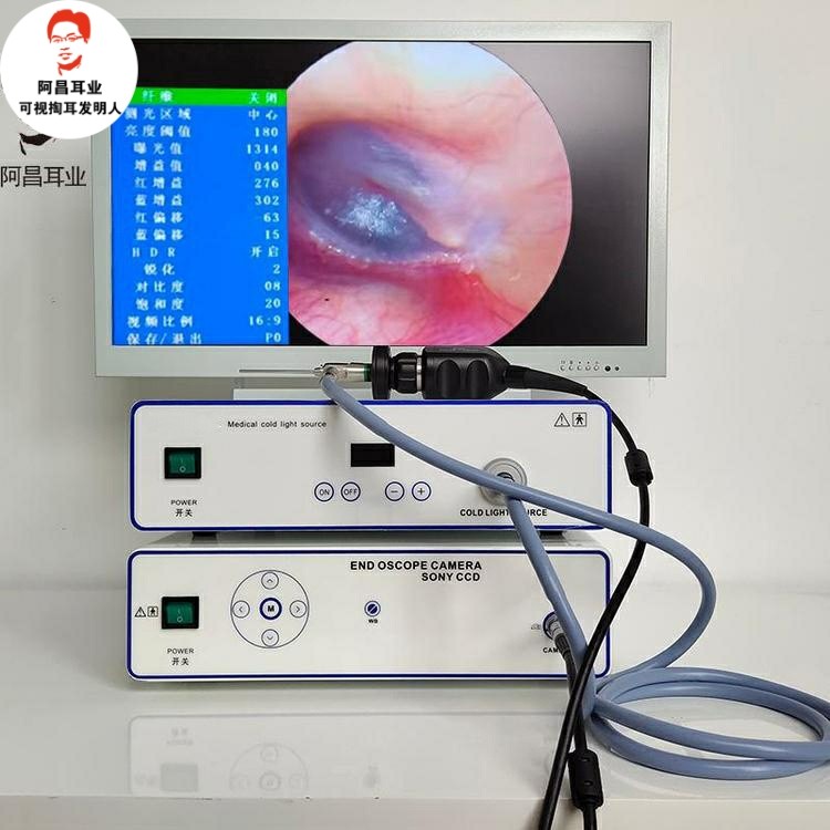 可视采耳设备台式主机高清耳鼻喉冷光源掏耳朵仪器专业开店掏耳朵