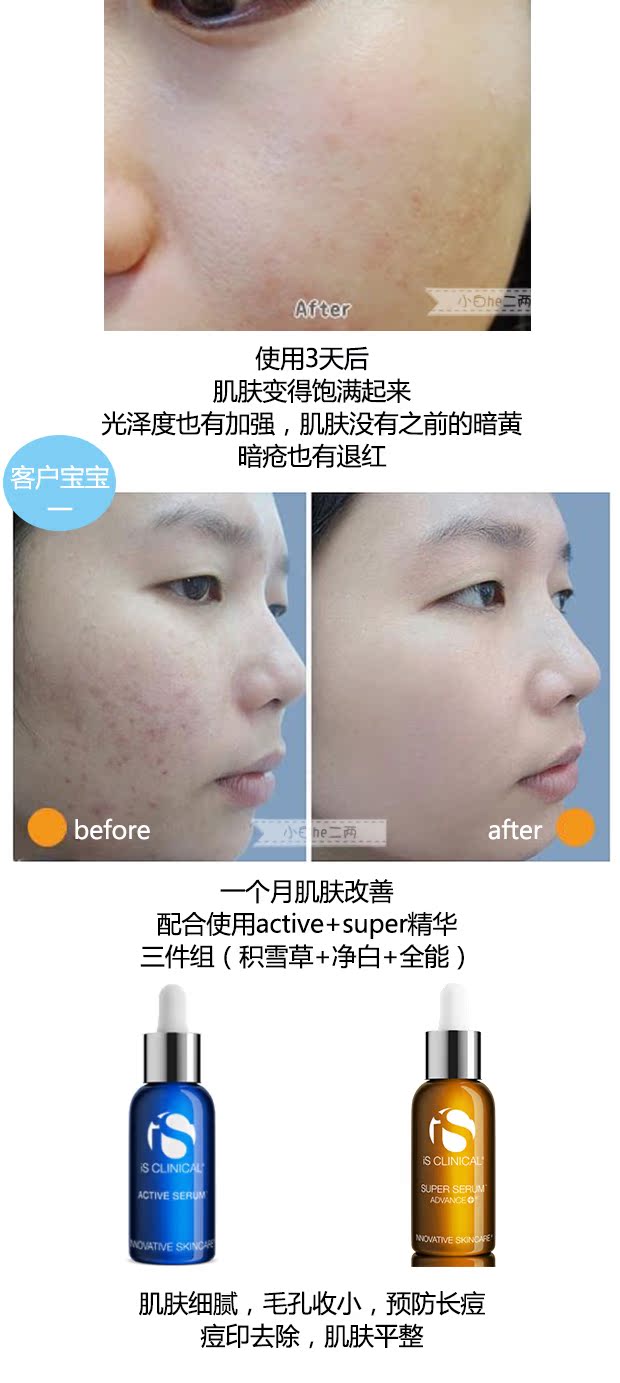 Là lâm sàng Centella asiatica huyết thanh hyaluronic acid chính hãng làm săn chắc lỗ chân lông serum esthemax