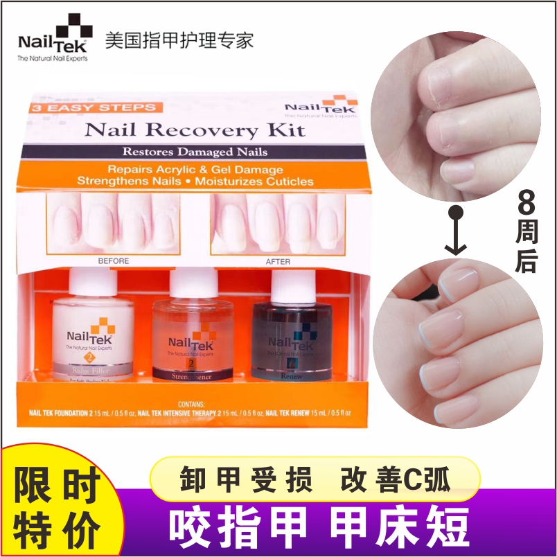 Nailtek Nail Growth Fluid Crossbar Repair Armor Oil Finger Rim Bottom Oil Meme Damage Improvement C Arc Adoptive Chia Bed