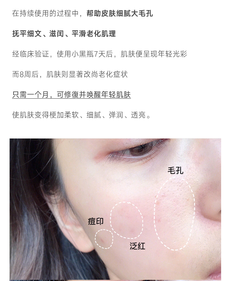 Lancome Lancome chai nhỏ màu đen kem nền dưỡng ẩm và phục hồi da mặt tinh chất dưỡng ẩm thế hệ thứ hai mới 100ml serum 561