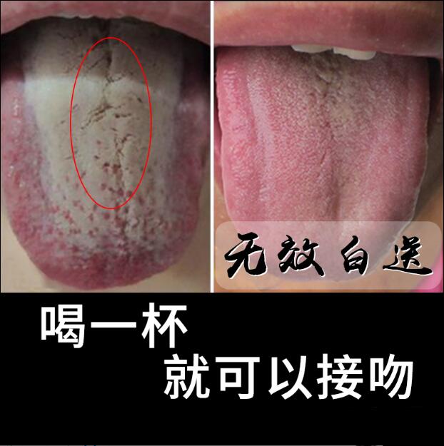 口腔異味除去口臭口苦口乾口氣重清新舌苔厚白髮黃三清調理腸胃 口腔異味除去口臭口苦口乾口氣重清新舌苔厚白髮黃三清調理腸胃