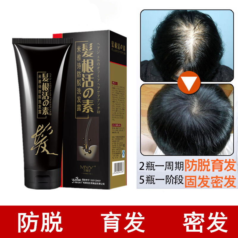 A wash of black shampoo Miyya poetry shampoo with hair lotion and hair loss and hair loss and hair loss and hair loss