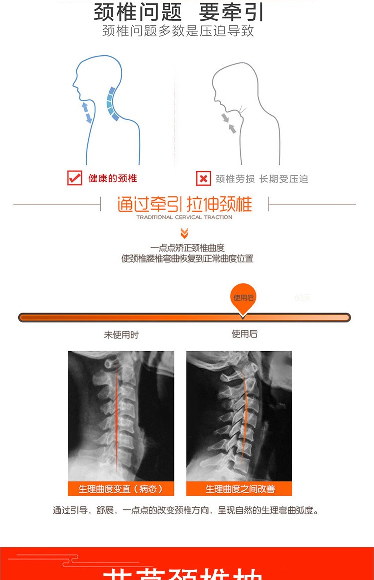 Ai Cao gối cổ tử cung sửa chữa cổ tử cung tròn gối đơn gối đặc biệt vật lý trị liệu gối cổ gối Ai Luo gối gối chống trào ngược monmon