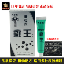 Skin expert ringworm King ointment skin topical antipruritic husband expert ointment counter adult cowhide head Moss
