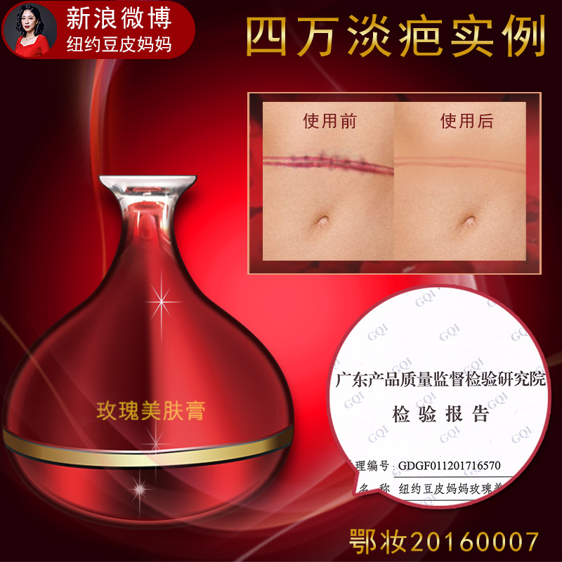 Rose skin beauty cream red itching burn scar lump caesarean section surgery needle hyperplasia new york bean skin mother