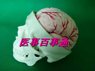 厂家直销  人体头骨带脑动脉模型  带八部件脑动脉模型、头骨模型
