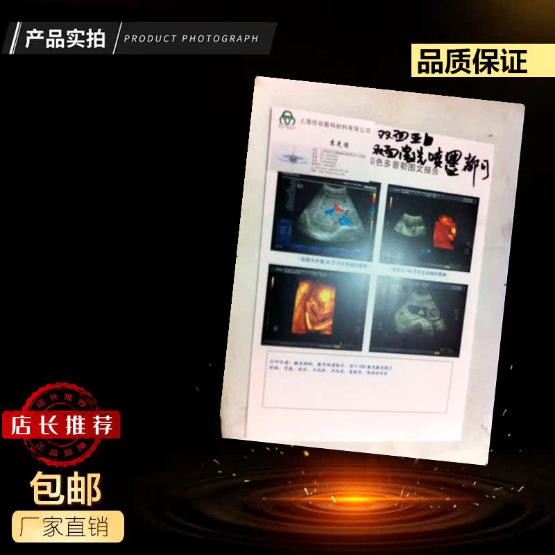 (17 5S) high gloss porcelain white 16K 184*260 medical color print B ultrasound color ultrasound 2000 box