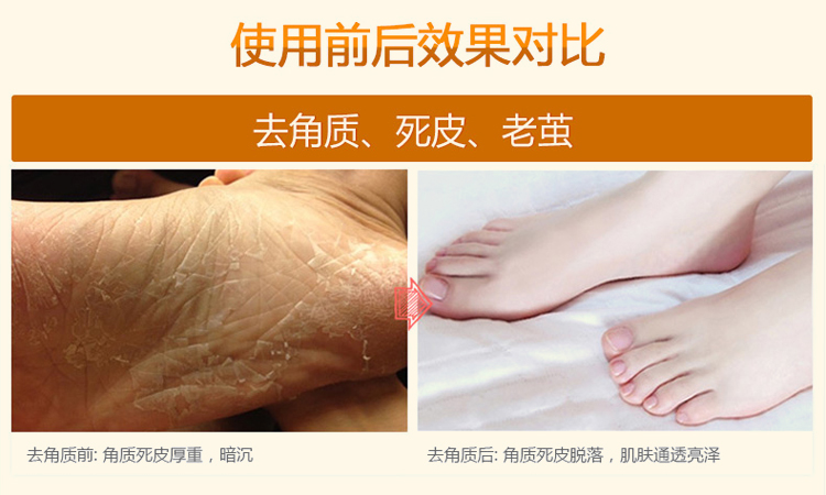 Yalanka Chà Chân Tẩy Tế Bào Chết Kem Chà Kem Chân Tẩy Tế Bào Chết Chân Cũ Feet 200 gam Chăm Sóc Bàn Chân kem dưỡng da tay chân