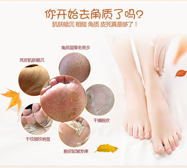Yalanka Chà Chân Tẩy Tế Bào Chết Kem Chà Kem Chân Tẩy Tế Bào Chết Chân Cũ Feet 200 gam Chăm Sóc Bàn Chân kem dưỡng da tay chân