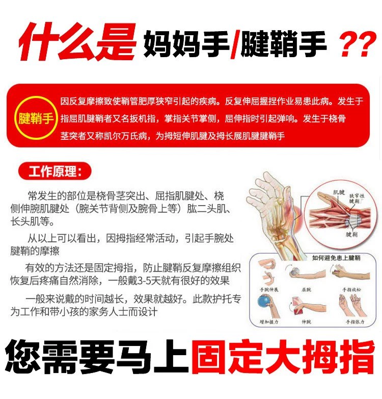 Cố định ngón tay cái bong gân cổ tay mẹ bảo vệ trẻ em gãy cổ tay gân vỏ mùa hè ngón tay giữ đàn ông và phụ nữ - Dụng cụ thể thao