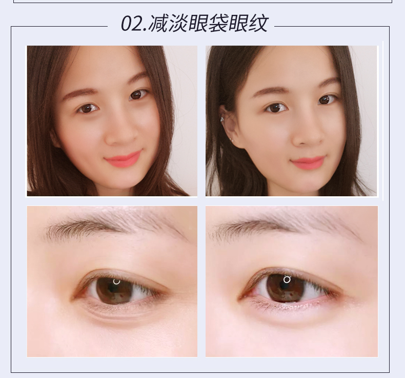 Xue Ling Yan Kem Mắt Tinh Chế Nhăn Mắt Túi Mắt Pattern Fat Grain Nâng Da Nam Giới và Phụ Nữ Dưỡng Ẩm Chăm Sóc Mắt tẩy trang mắt môi