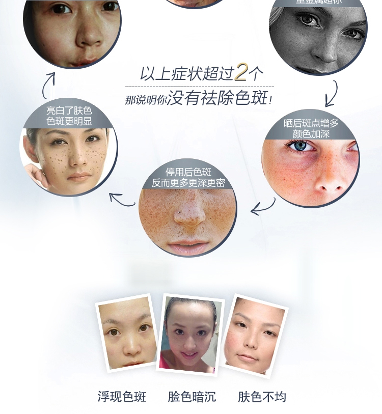 Hange Freckle Spot Correction Essence Water Moisturising Facial Fading Spot mụn mark Làm sáng tông màu da Thu nhỏ lỗ chân lông serum ciracle b5