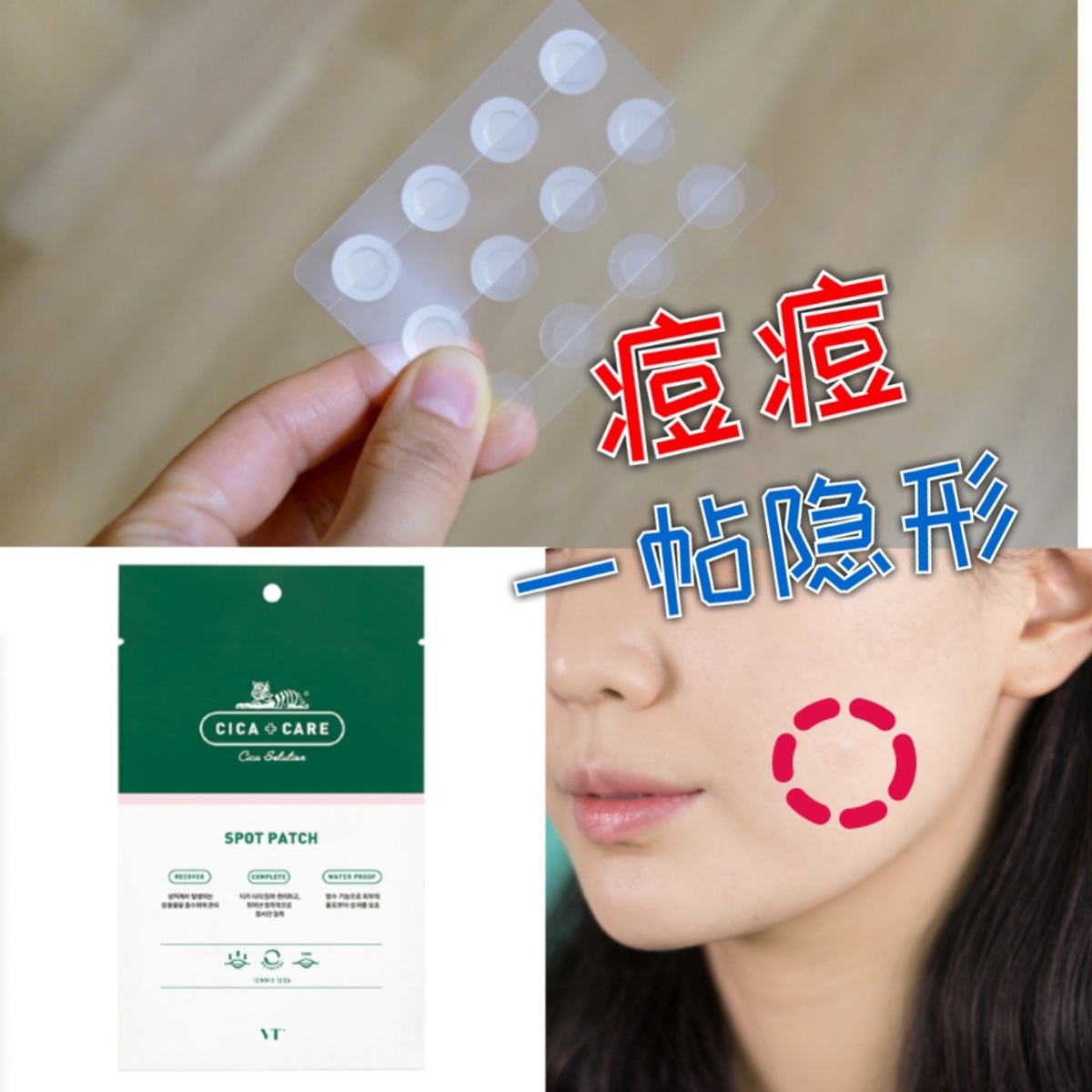 South Korea VT Invisible Pimple to stick with CICA repair and paste Acne Pimple Acne pimple pimple with closed mouth anti-sensitive 12 sticker