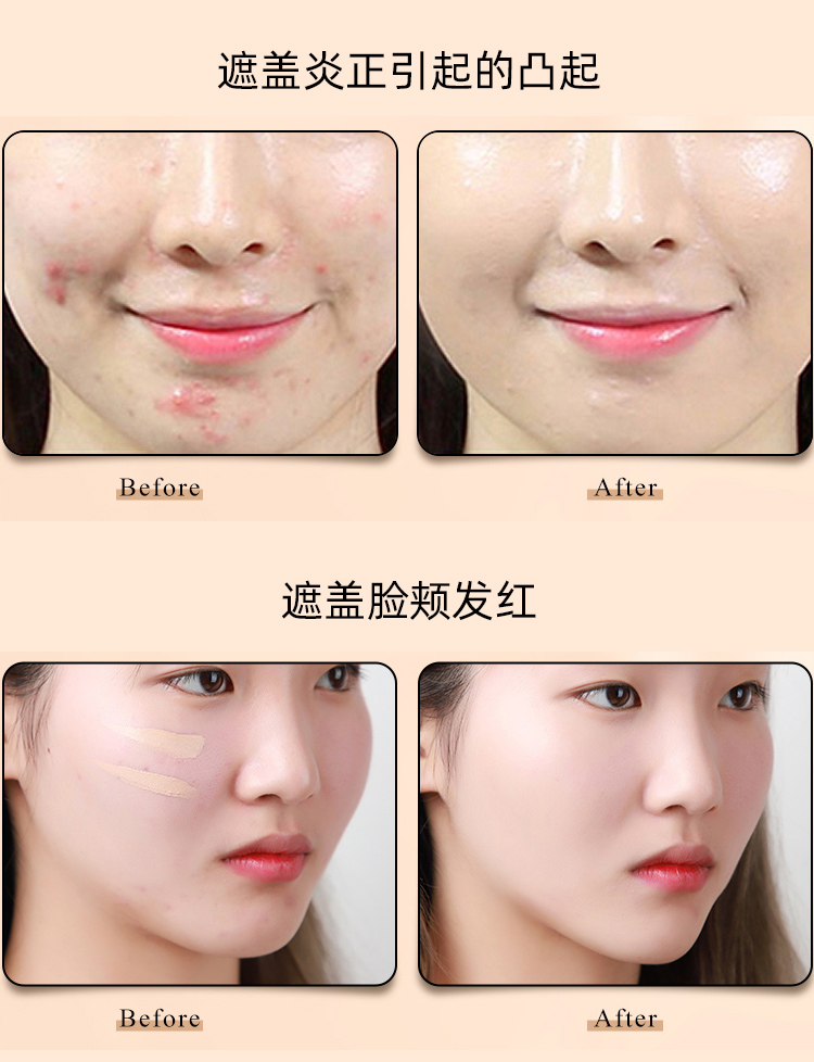 VT Kem che khuyết điểm Tiger Kem che khuyết điểm Paste Gã khổng lồ bị che khuất mụn trứng cá Cove mụn trứng cá lấp lánh mặt tối màu lâu dài che khuyết điểm kryolan