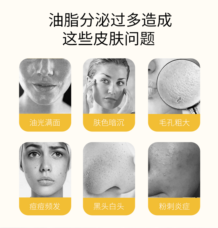 New Zealand Mystery Đá Bùn Núi Lửa Amino Acid Sữa Rửa Mặt Cho Nữ Làm Sạch Sâu Thu Nhỏ Lỗ Chân Lông Nam Kiểm soát dầu và Loại bỏ Mụn trứng cá Sinh viên sữa rửa mặt ngừa mụn
