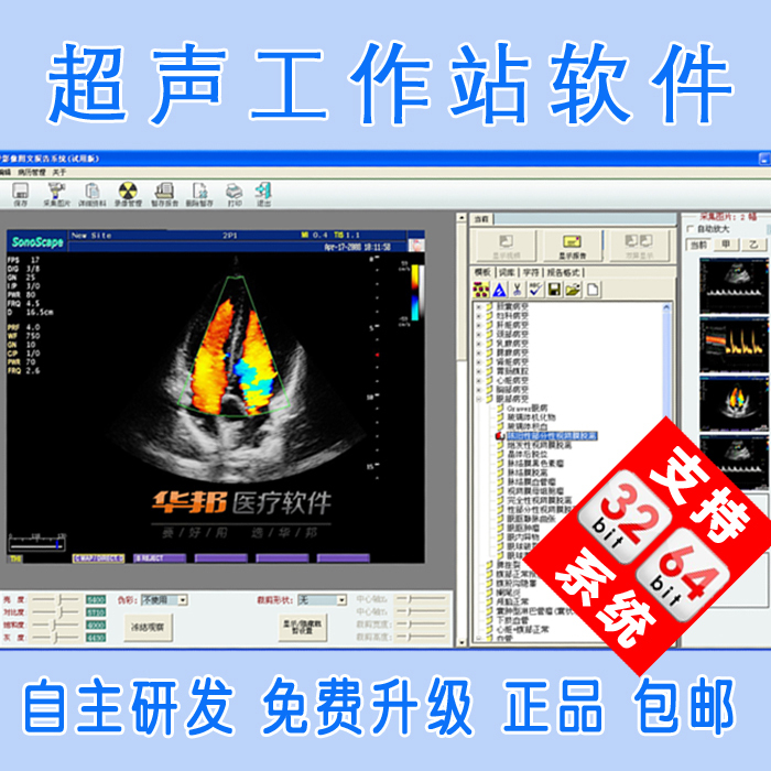 Ultrasound Workstation Software, Ultrasound Software, Color Ultrasound Software, Medical Imaging Workstation Software
