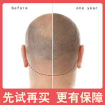 Anti-hair loss shampoo ladies Yukon liquid Thickened Hair Boy Ginger Pure Plant Severe Solid Hair Control Oil Raw Hair Lotion