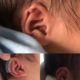 Ear corrector baby silicone newborn baby auricle ear support lop ear ear clip correction shaping artifact