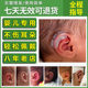 Ear corrector for babies, special for newborns, auricles, ear braces, ear braces, ear clips to correct and shape the ears