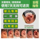 Baby auricle correction artifact baby ear lop ear flapping ear ear clip shaping newborn silicone ear deformity