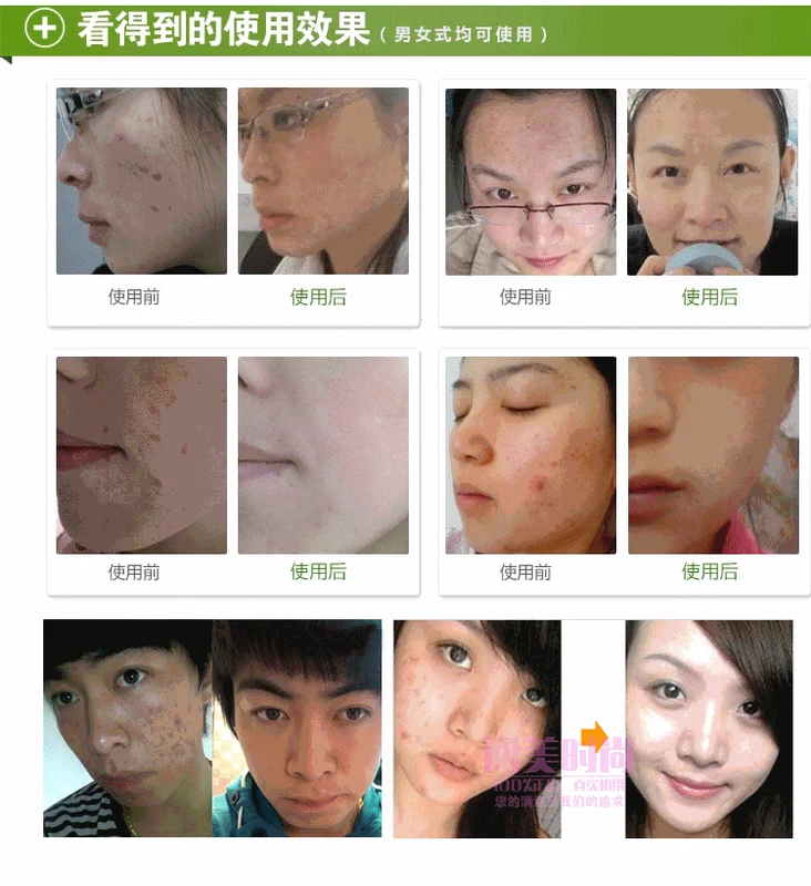Một Qi Na rong biển bùn dầu kiểm soát mụn trứng cá làm sạch sữa nam giới và phụ nữ giữ ẩm để mụn trứng cá để l mụn đầu đen mụn dấu hiệu sữa rửa mặt cetaphil sữa rửa mặt