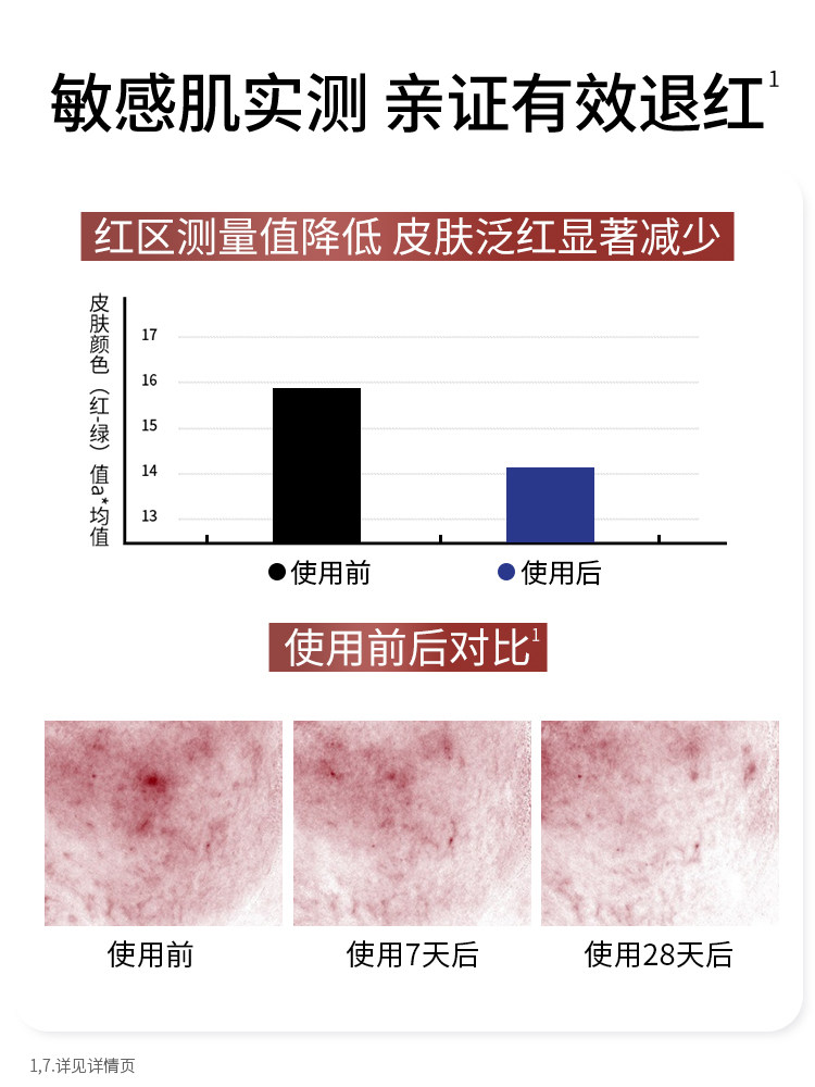 Kangaroo Mom Alpine Edelweiss Essence Pregnant Women's Skin Care Products Soothing and Hydrating Special Moisturizing Essence Genuine