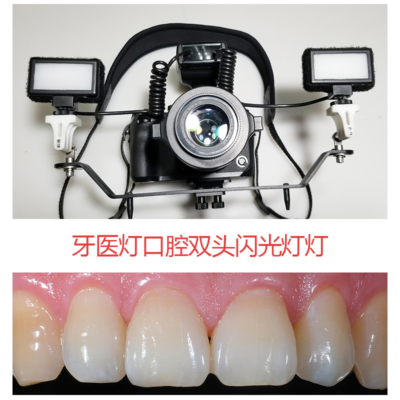 Dentist lamp holder cavity lamp double head flash including stent oral health dentist Clinical guago micropitch