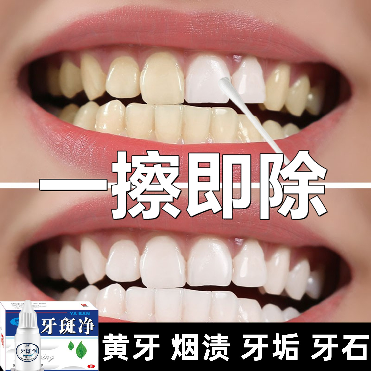 歯のホワイトニングパウダーは、黄ばみを取り除き歯を白くし、歯を明るくし、タバコのヤニ汚れを除去します。また、口臭や歯石を素早く溶かす洗浄剤でもあります。