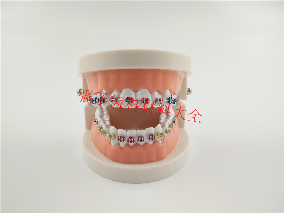 牙科材料正畸模型口腔科牙齿模型金属托槽颊面管模型医患沟通教学