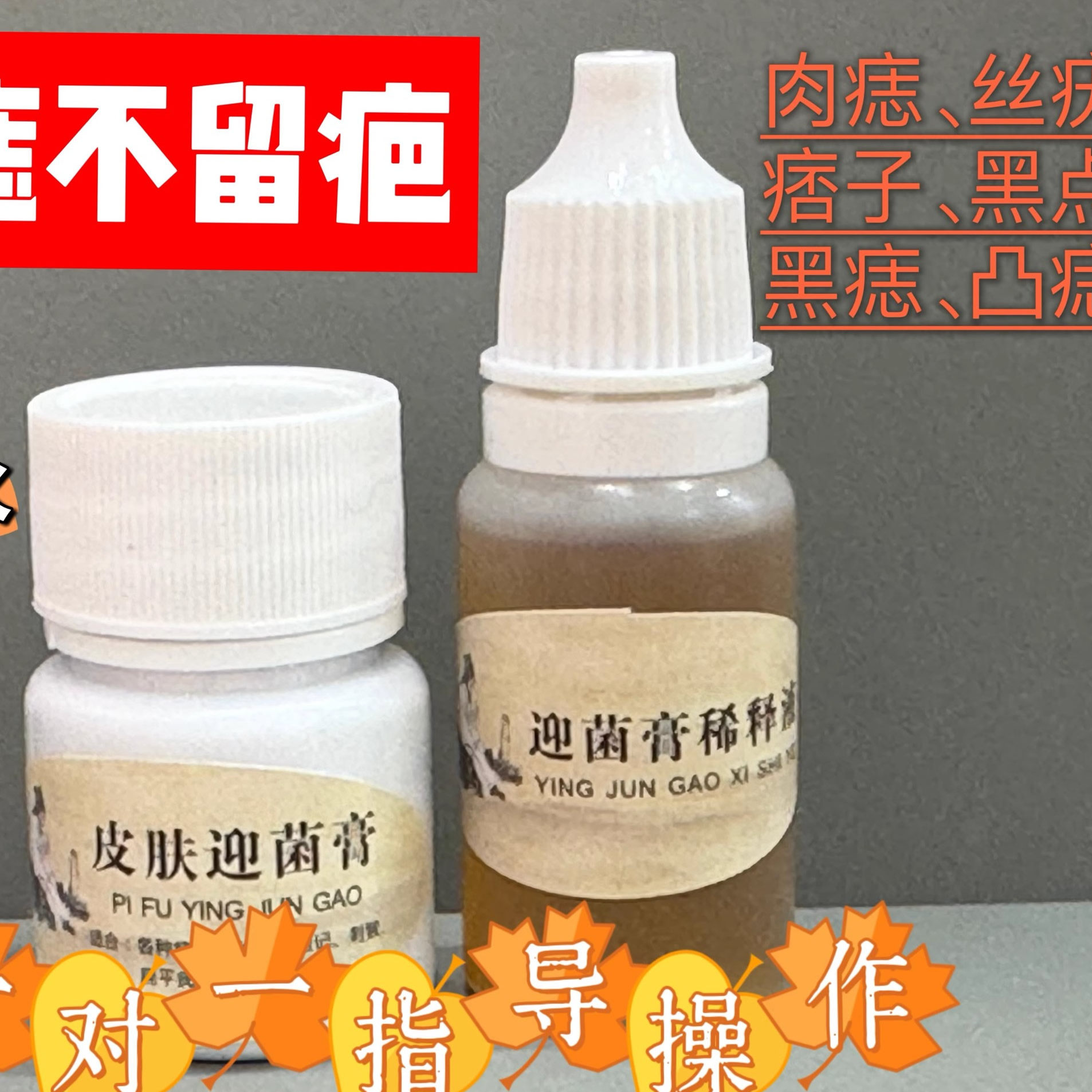 曲氏点痣膏：告别肌肤瑕疵，周方净颜点痣膏的神奇力量！