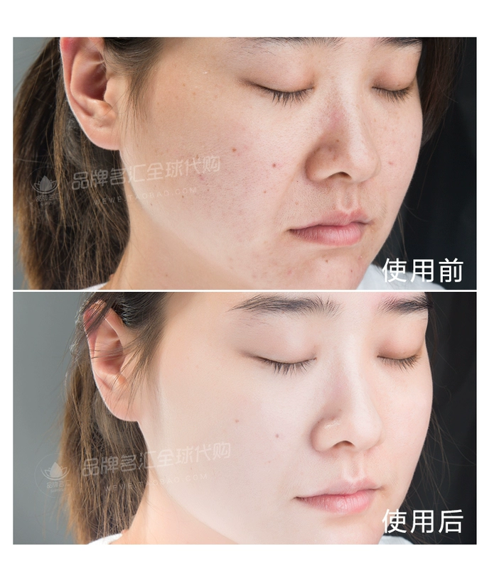 Thái Lan Atreus Regeneration BB Cream Lasting Concealer Dưỡng ẩm Lỗ chân lông vô hình Sửa chữa Kem nền làm sáng da 30g