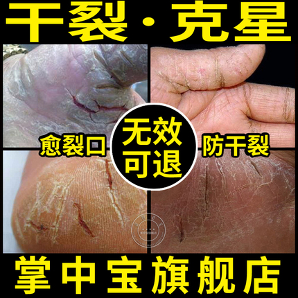 手裂口脚裂膏手脚干裂开裂防裂膏特效成人护手