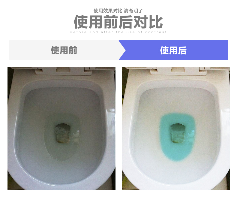 Thỏ điện bong bóng màu xanh vệ sinh vệ sinh nhà vệ sinh nhà vệ sinh vệ sinh bóng khử mùi kho báu kháng khuẩn 2 thẻ nạp - Trang chủ nước chà bồn cầu