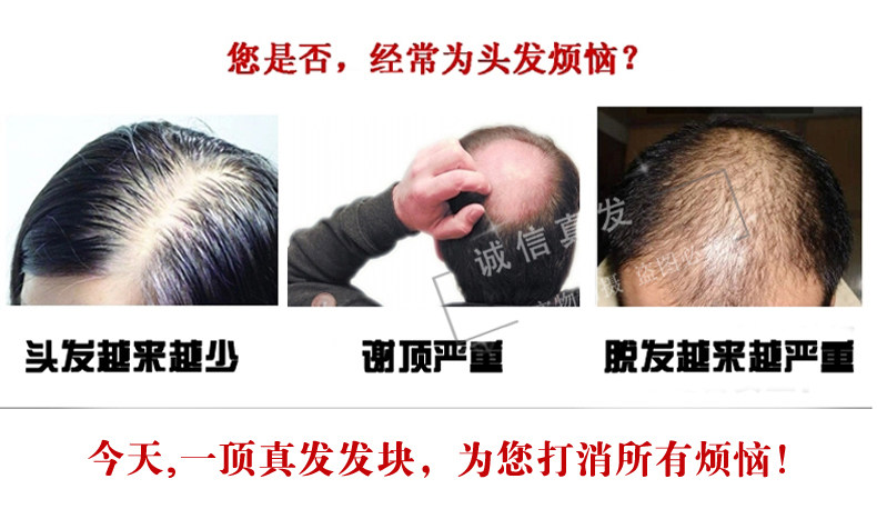 Extension cheveux - Ref 219528 Image 7