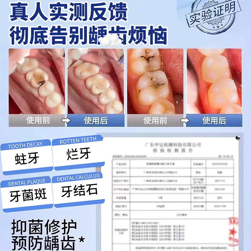 🦷拯救你的牙齿!速效救牙再生硅牙膏,让你远离蛀齿困扰🔍-牙膏-淘宝好物网