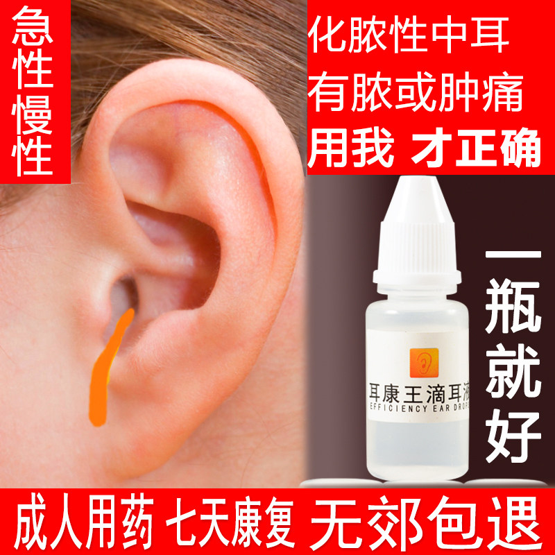 Human use middle ear suppurative ear drops Ear inflammation suppuration special potion chronic eardrum perforation swelling pain Ear Kangwang