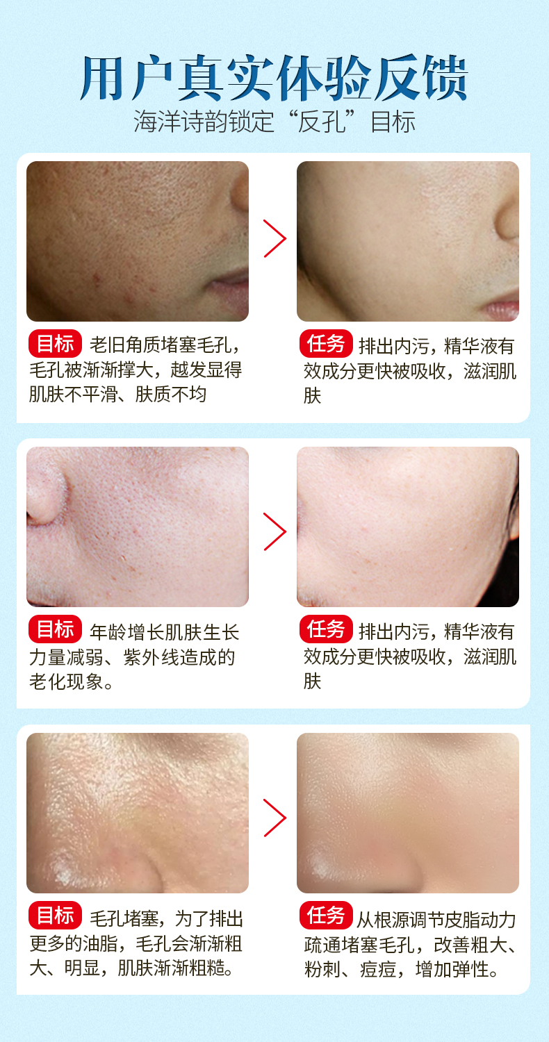 Đại dương thơ thu nhỏ lỗ chân lông bản chất lỗ chân lông thô sửa chữa người đàn ông và phụ nữ thắt chặt tốt mặt bản chất serum ahc mẫu mới 2020