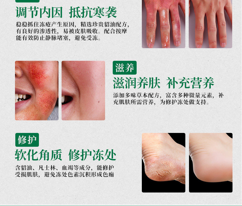 云南本草冻疮膏止痒 防冻霜防裂膏去手脚干裂