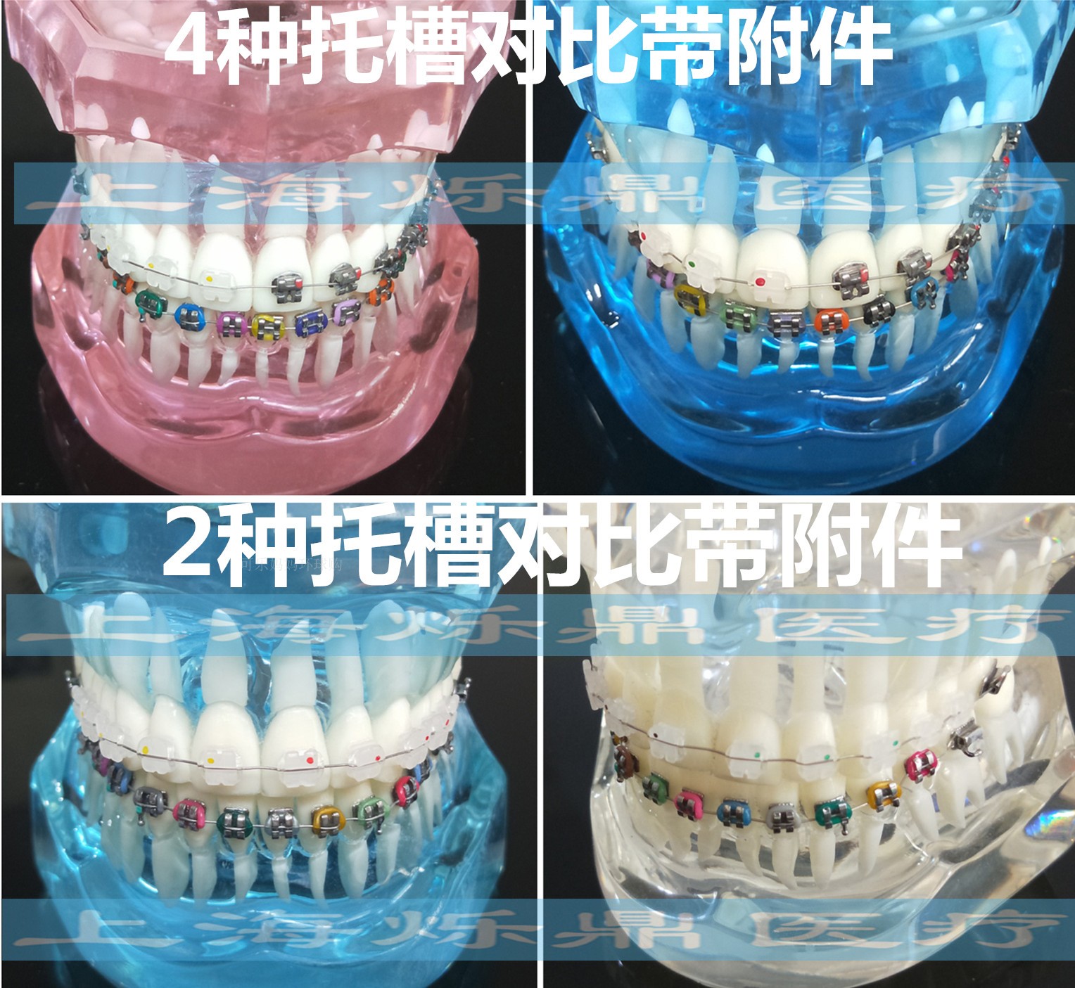 Dental orthodontics Orthodontic Orthodontic Trough Contrast Model Dental Mold Transparent doctor-patient Communication Teaching
