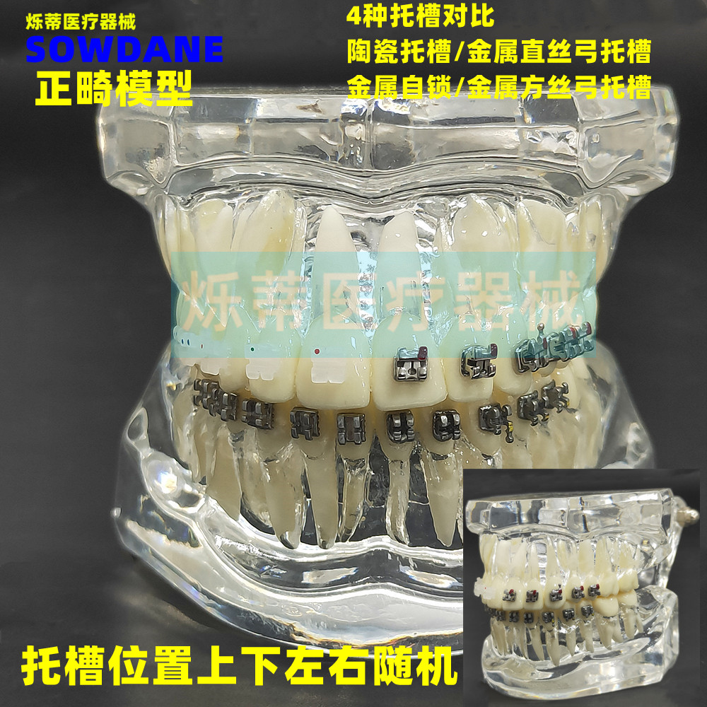 牙科正畸模型金属托槽陶瓷托槽透明4对比牙模教学讲解医患沟通牙