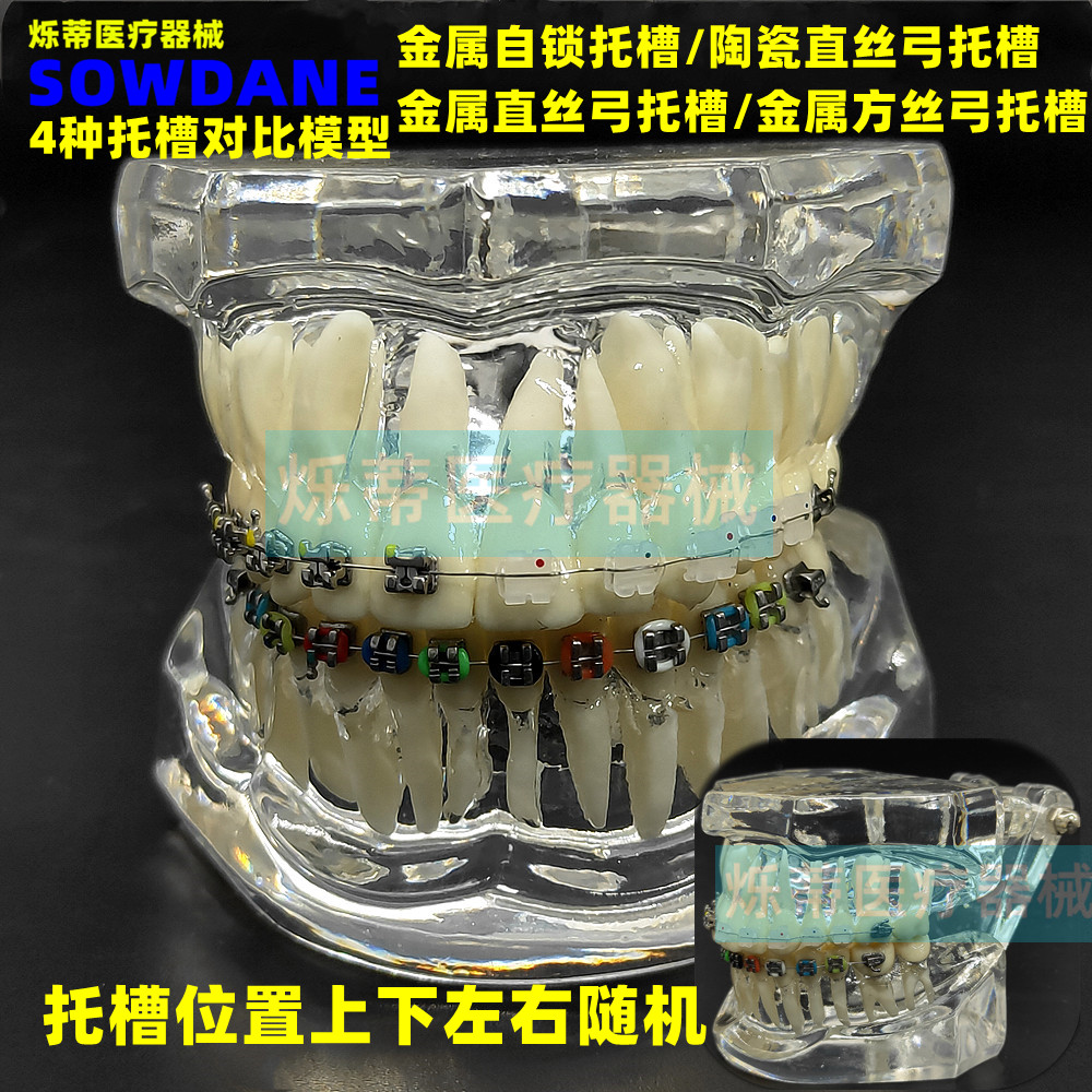 Dental Orthodontic Tooth Model Metal Self-Lock Ceramic Nursery Trough Metal trough 4 contrast model Teaching doctor-patient ditch