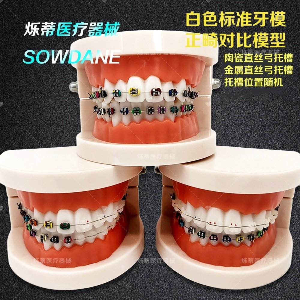牙科口腔病理修复模型/种植模型/正畸模型医患沟通教学牙模