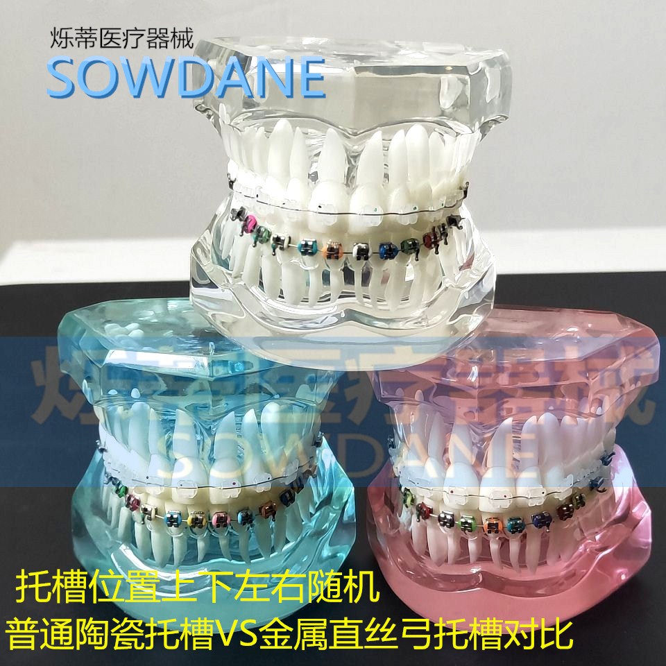 2种托槽金属陶瓷隐形牙科正畸模型对比效果展示牙模教学医患沟通