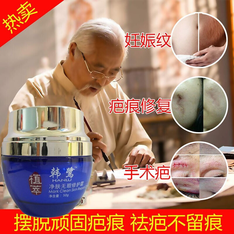Hanlu scar cream Scar paste Face bump scar repair hyperplasia surgery scalding light scar care acne mark