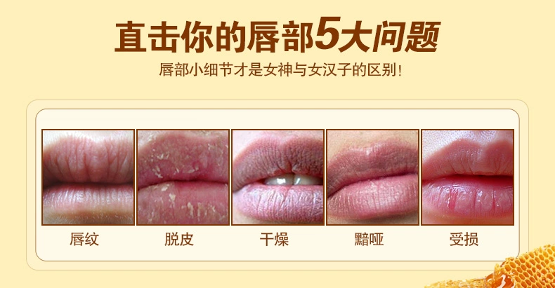 Thơ ca sáp môi mật ong Collagen dưỡng ẩm cao làm sáng đôi môi Không màu giữ ẩm cho bà bầu có sẵn để sửa chữa lâu dài - Son môi
