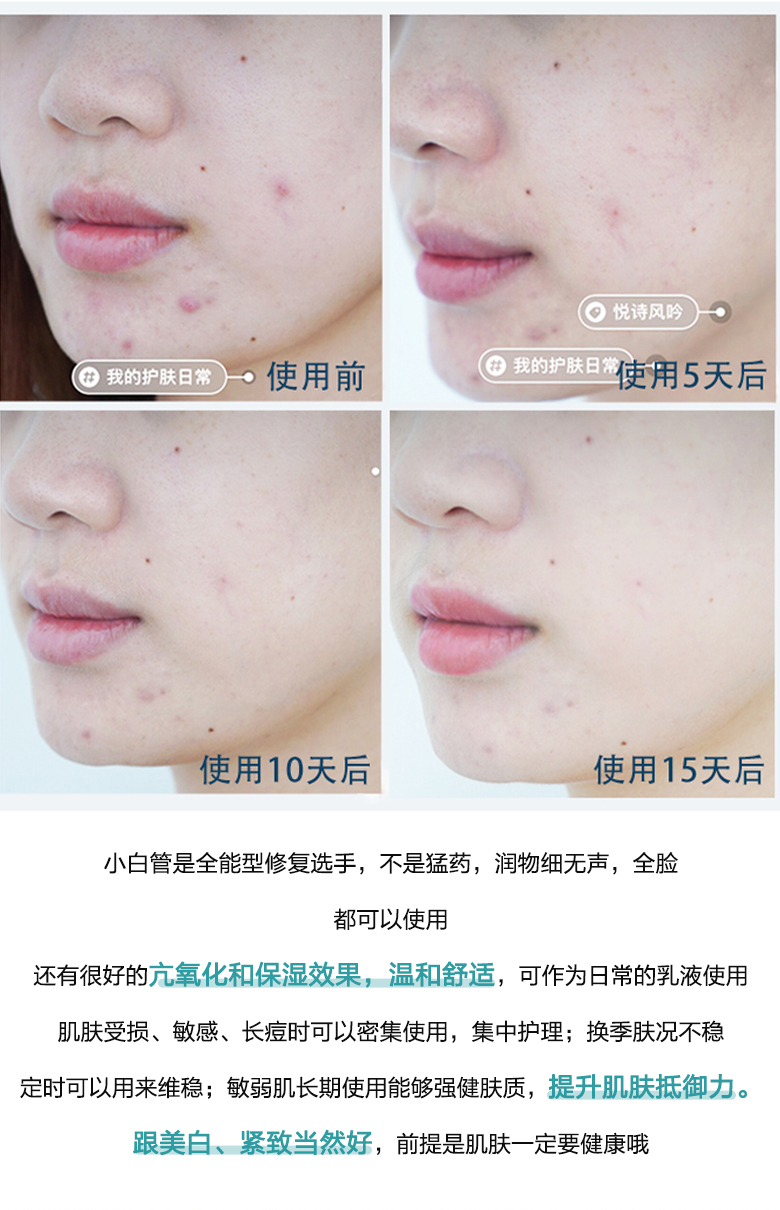 Hàn Quốc Innisfree Yue Shi Feng Xiaoli ống trắng thơm thuốc mỡ acse tinh chất sửa chữa cica kem