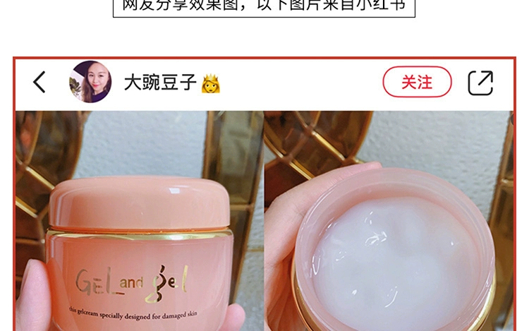 Nhật Bản Shonan So nhẹ Repair Cream Mỹ phẩm Phục hồi Nước Sữa Tinh chất Ba trong Một Kem dưỡng chất Lười biếng 150g - Kem dưỡng da kem dưỡng cho da mụn