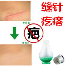 Products for cesarean section smoke-burned bumps scar marks from scalpels and removal of pigment marks from injuries caused by stitches.